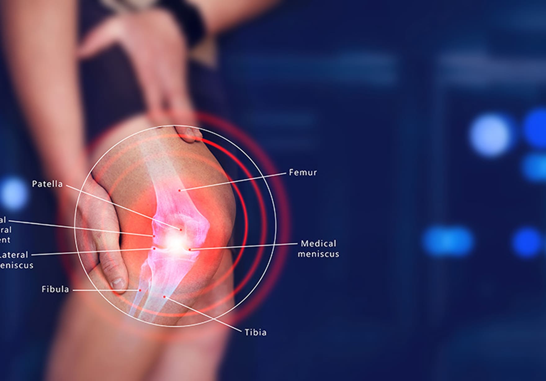 膝の痛みに悩む女性